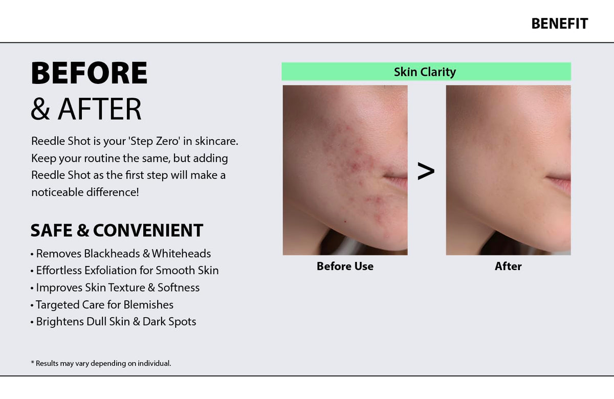 KURIOUS Collagen Spicule Shot 100 Liquid Microneedling Serum,
