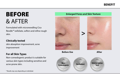 KURIOUS Collagen Spicule Shot 100 Liquid Microneedling Serum,