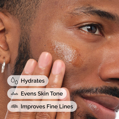 The Ordinary Retinol 1% in Squalane – Sérum Facial con Retinol para Líneas y Textura 30 ml