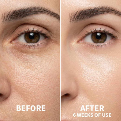 AURA Smoothing Face Serum – Sérum Facial con Bakuchiol y Niacinamida 100 ml