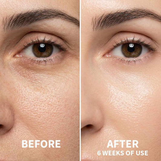 AURA Smoothing Face Serum – Sérum Facial con Bakuchiol y Niacinamida 100 ml