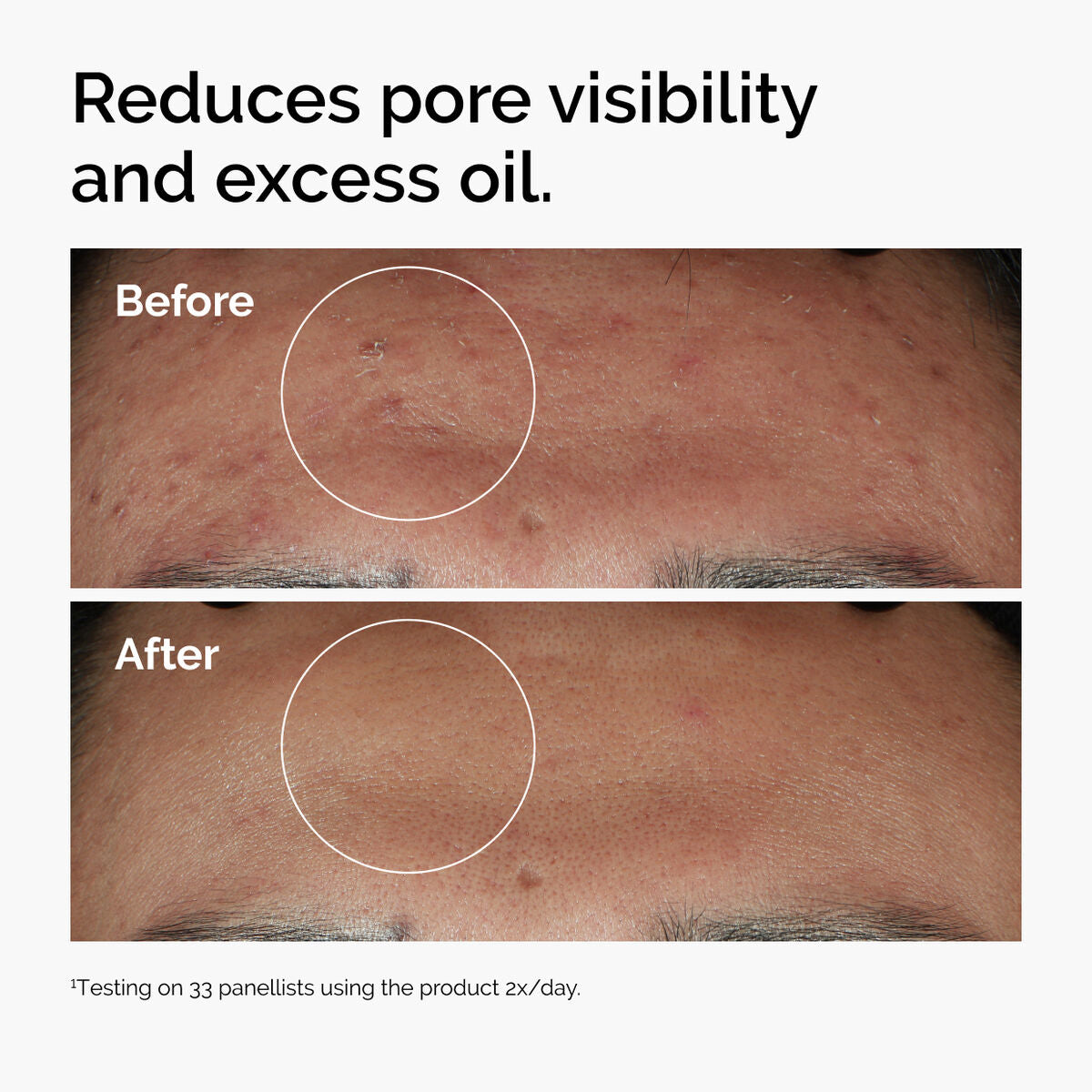 The Ordinary Niacinamide 10% + Zinc 1% – Sérum Facial para Poros y Exceso de Grasa 30 ml